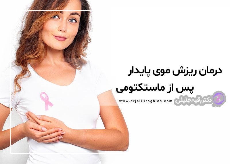 درمان ریزش موی پایدار پس از شیمیدرمانی ماستکتومی و بازسازی سینه